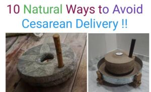how to prevent cesarean delivery, how to avoid cesarean delivery in india,